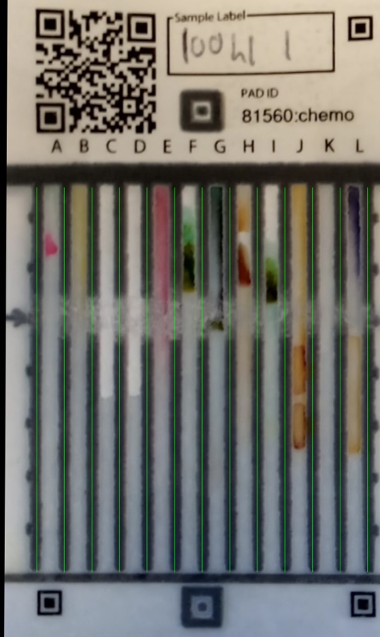 A rectified ChemoPAD card, ID 81560, with twelve reagent lanes labelled A to L showing colour reactions.